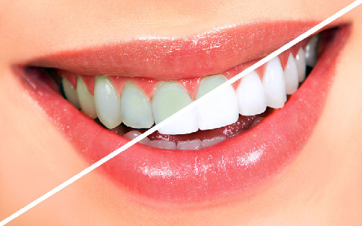  Чтобы улыбка сверкала, как в рекламе: как правильно чистить зубы? 