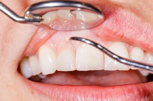 Названы 7 распространенных привычек при чистке зубов, которые разрушают эмаль и десны