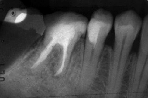 Судебная стоматология: больше чем просто идентификация
