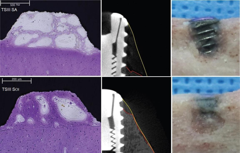 Влияние гидрофильной поверхности SOI на ранние этапы остеоинтеграции дентальных имплантатов