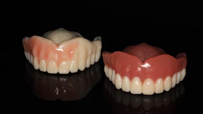 Зубной протез с 3D-печатью вполне пригоден для длительного клинического использования