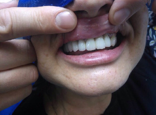 Стоматолог Шаргородский назвал разрушающую зубы частую привычку